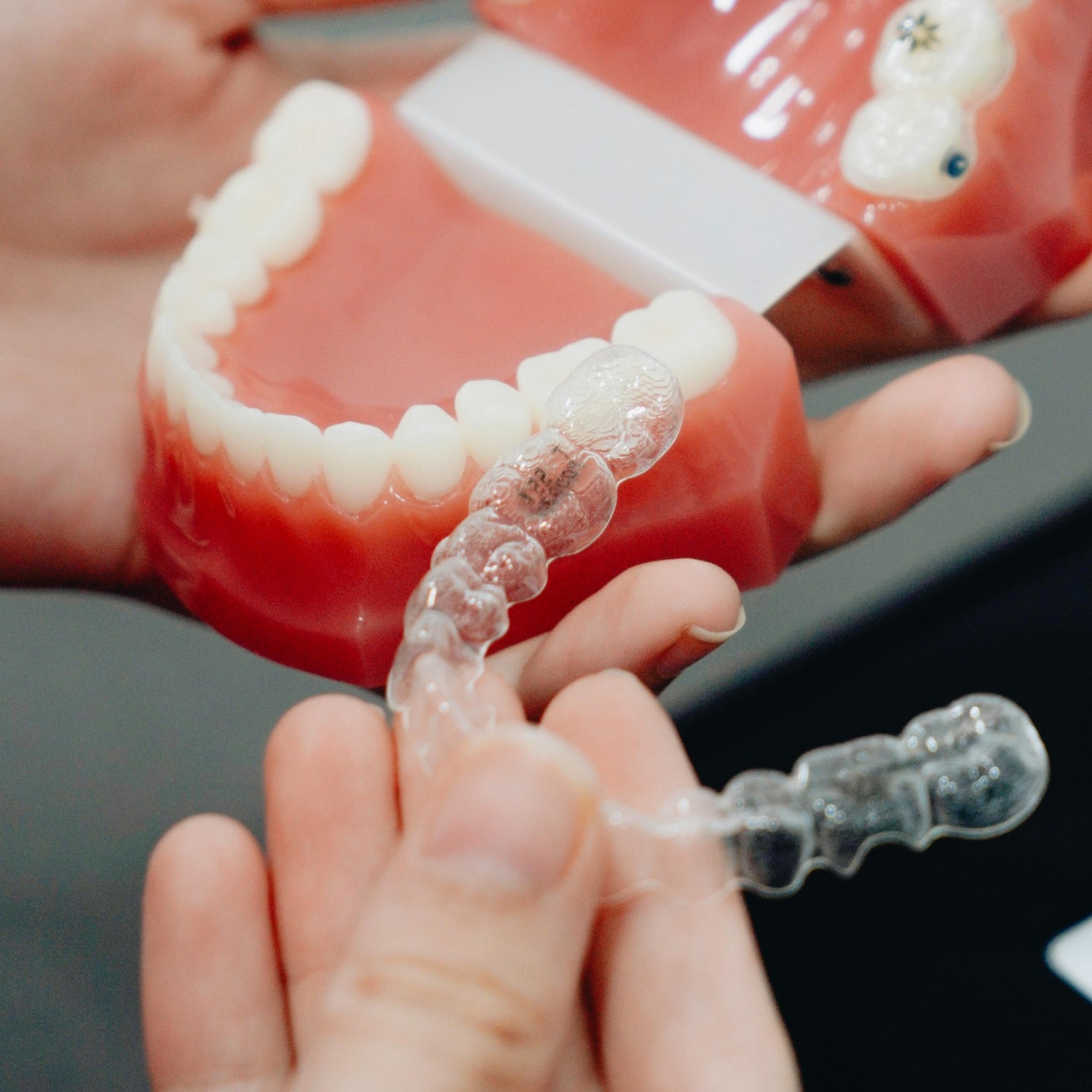 Clear aligner orthodontic service at Niko Dental Dhangadhi